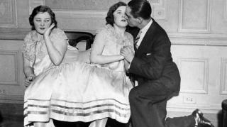 Як народжуються й живуть сіамські близнюки: фото